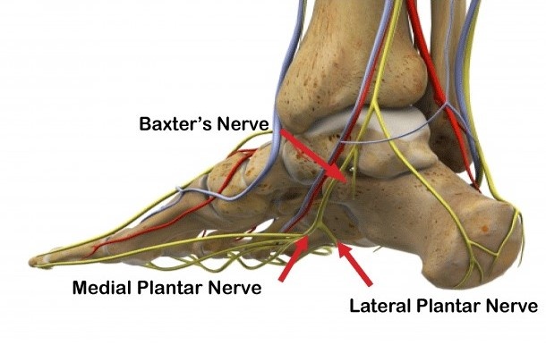 Heel Pain Compressed Nerve