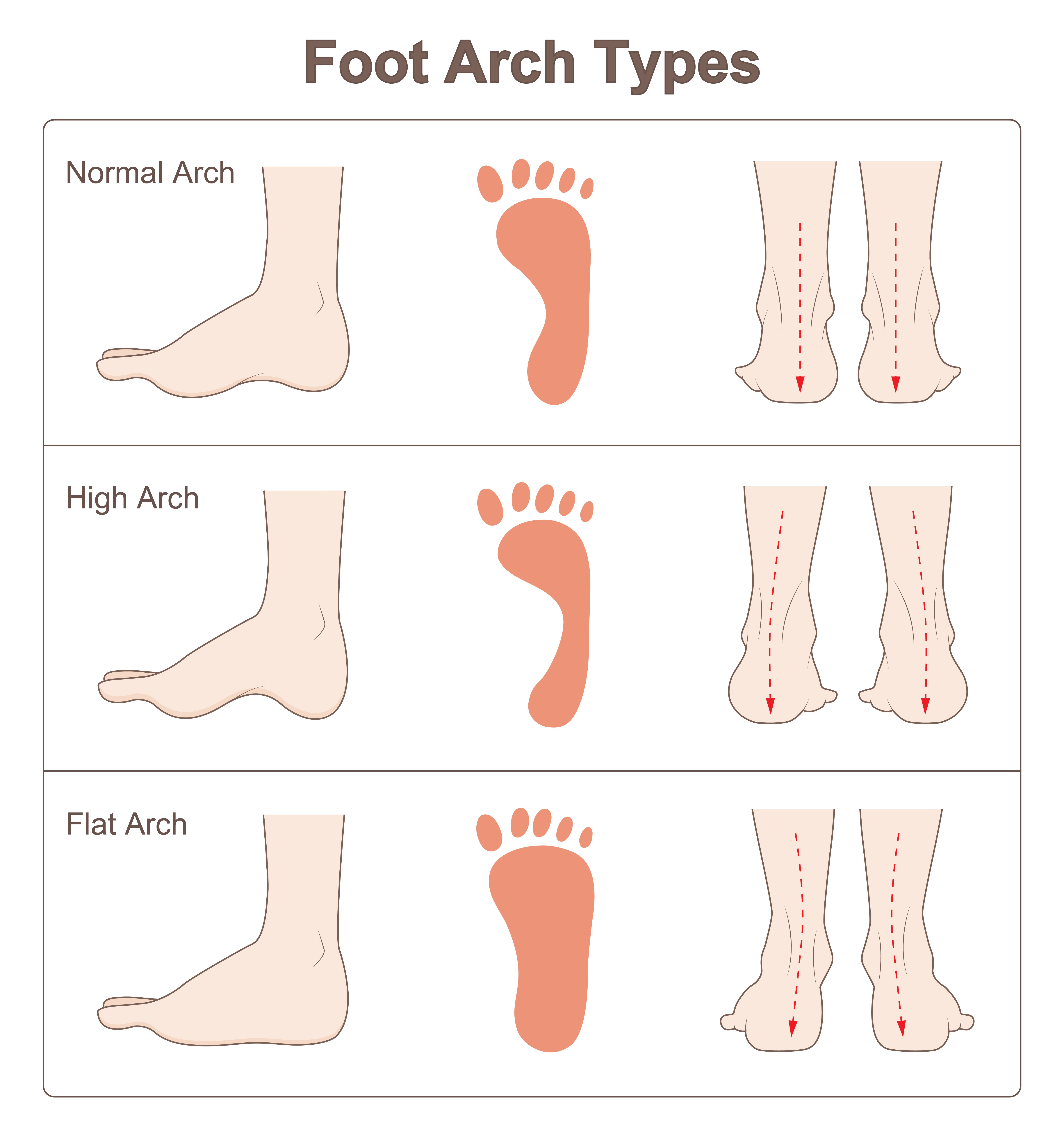 Image of Foot Arch Types